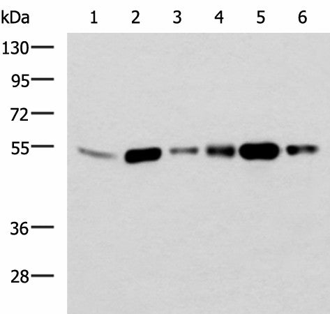 BECN1 Polyclonal Antibody – Figure 1 of 4