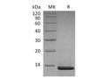 Recombinant Human β-NGF/NGFB Protein (aa 122-239, Human Cells) – Figure 1 of 3