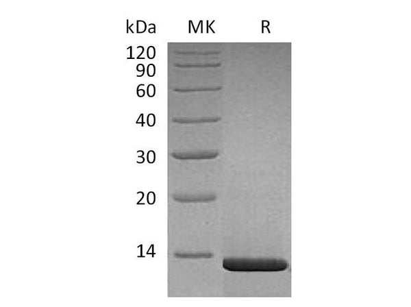 Recombinant Human β-NGF/NGFB Protein (aa 122-239, Human Cells) – Figure 1 of 3