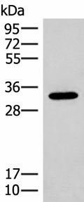 RGR Polyclonal Antibody – Figure 1 of 3