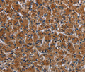 IRGM Polyclonal Antibody – Figure 1 of 3