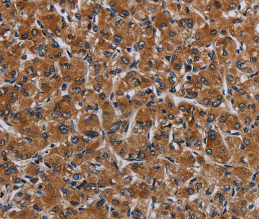 IRGM Polyclonal Antibody – Figure 1 of 3