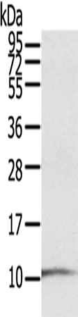 S100P Polyclonal Antibody – Figure 1 of 2
