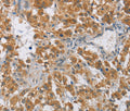 DIO1 Polyclonal Antibody – Figure 1 of 3