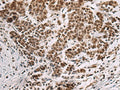 CREBBP Polyclonal Antibody – Figure 1 of 3
