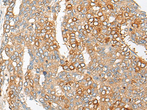 PCDHGB5 Polyclonal Antibody – Figure 1 of 3