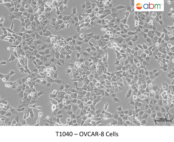 Ovcar8 Cells – Figure 1 of 1