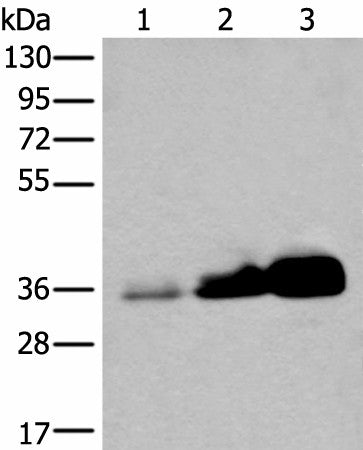 UBE2Z Polyclonal Antibody – Figure 1 of 4