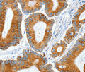 MANF Polyclonal Antibody – Figure 1 of 3