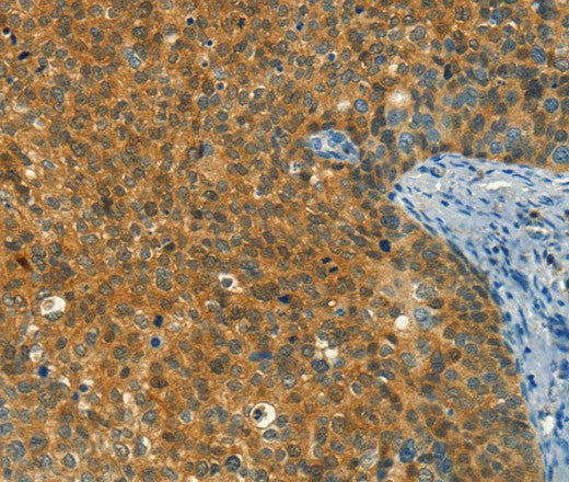 DIRAS1 Polyclonal Antibody – Figure 1 of 3
