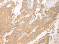 ASIC3 Polyclonal Antibody – Figure 1 of 2