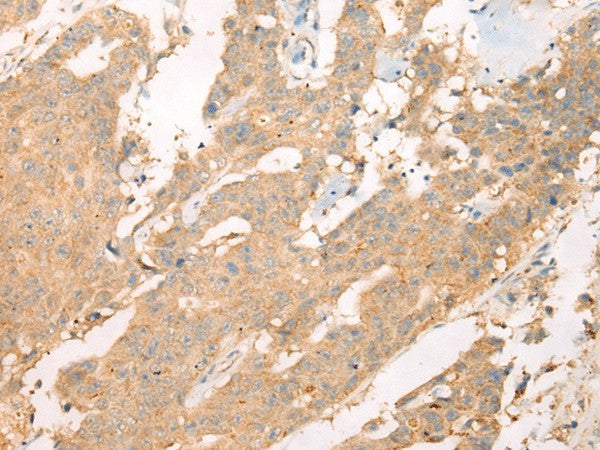 ASIC3 Polyclonal Antibody – Figure 1 of 2