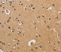 CST6 Polyclonal Antibody – Figure 1 of 3