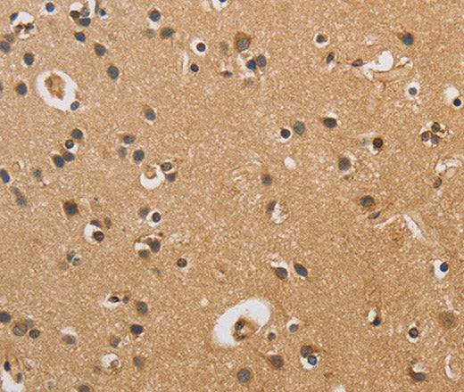 CST6 Polyclonal Antibody – Figure 1 of 3