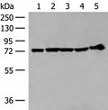 CALCOCO1 Polyclonal Antibody – Figure 1 of 4
