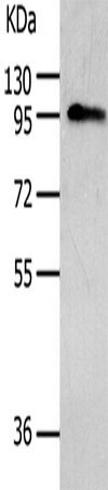 AKAP8 Polyclonal Antibody – Figure 1 of 3