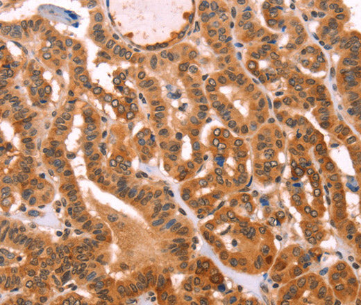 PROS1 Polyclonal Antibody – Figure 1 of 3