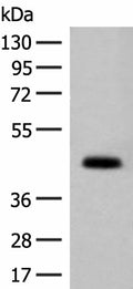 GPA33 Polyclonal Antibody – Figure 1 of 2