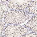 SIRT1 Polyclonal Antibody – Figure 1 of 4