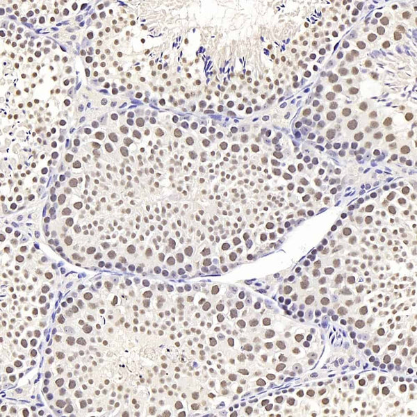 SIRT1 Polyclonal Antibody – Figure 1 of 4