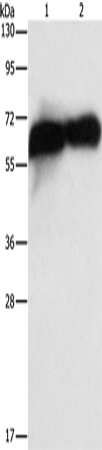 Placental Alkaline Phosphatase Polyclonal Antibody – Figure 1 of 4