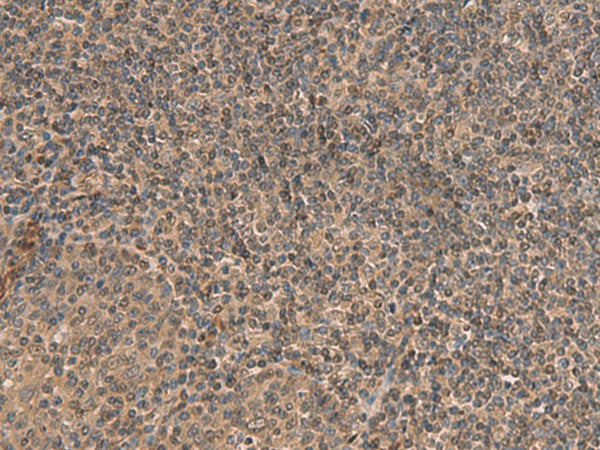HEBP2 Polyclonal Antibody – Figure 1 of 2