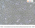 Immortalized Human Bone Marrow Mesenchymal Stem Cells - SV40T | Applied Biological Materials (abm)