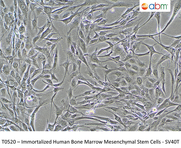 Immortalized Human Bone Marrow Mesenchymal Stem Cells - SV40T | Applied Biological Materials (abm)