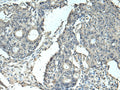 SLC35F6 Polyclonal Antibody – Figure 1 of 3