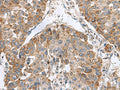 NFS1 Polyclonal Antibody – Figure 1 of 3