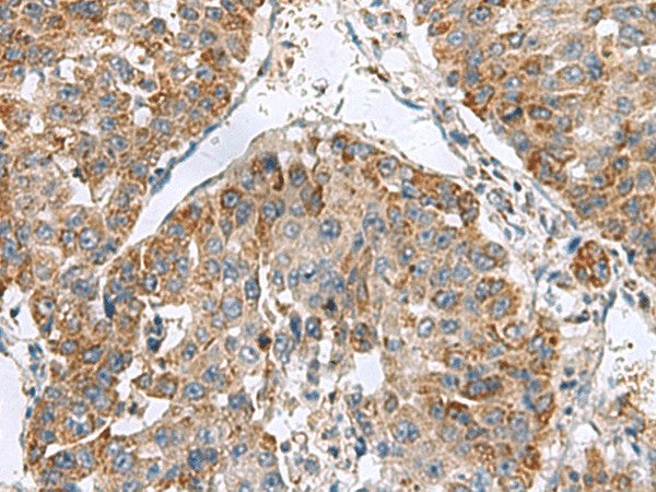 NFS1 Polyclonal Antibody – Figure 1 of 3