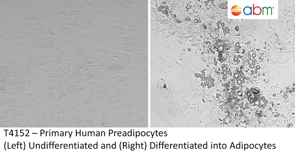Primary Human Preadipocytes | Applied Biological Materials (abm)
