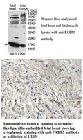 Anti-FABP3 Antibody – Figure 1 of 1