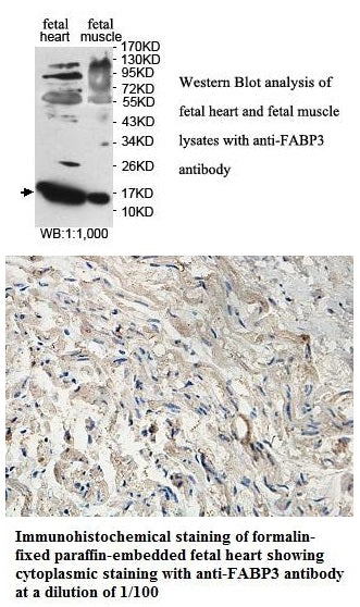 Anti-FABP3 Antibody – Figure 1 of 1