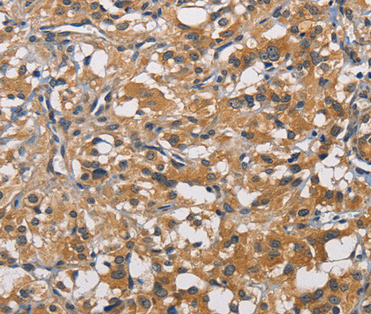 PIKFYVE Polyclonal Antibody – Figure 1 of 3