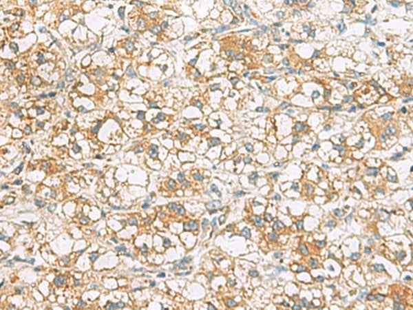 TLE6 Polyclonal Antibody – Figure 1 of 2