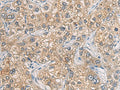 GAB4 Polyclonal Antibody – Figure 1 of 2