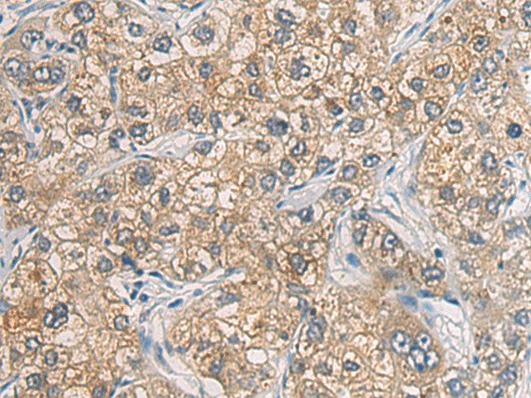 GAB4 Polyclonal Antibody – Figure 1 of 2