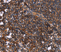 SYT4 Polyclonal Antibody – Figure 1 of 3