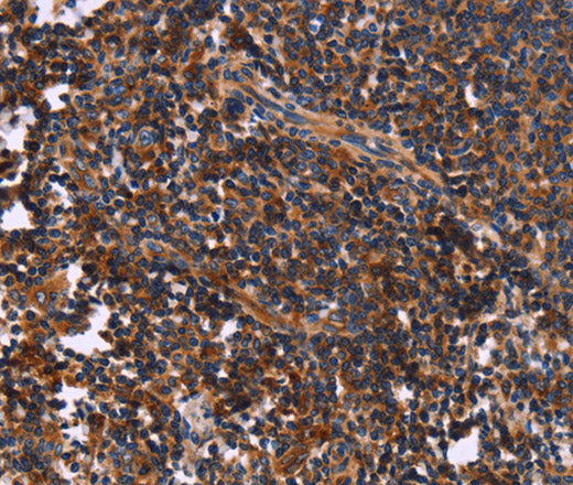 SYT4 Polyclonal Antibody – Figure 1 of 3