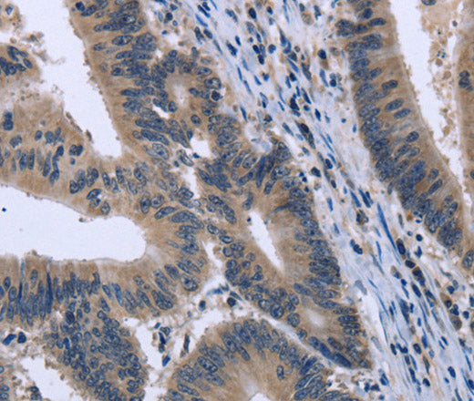 KCNJ11 Polyclonal Antibody – Figure 1 of 3