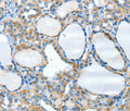 HID1 Polyclonal Antibody – Figure 1 of 2