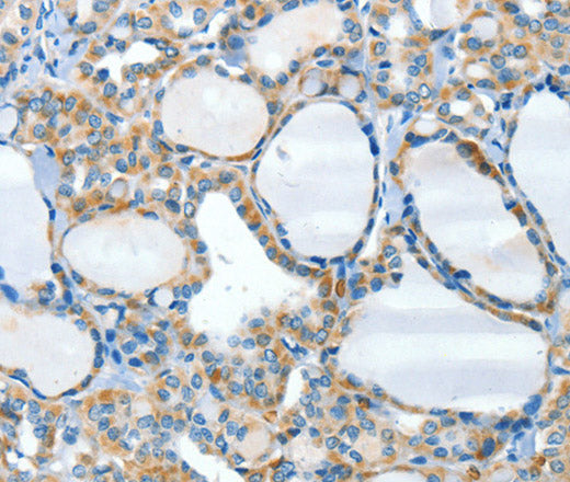 HID1 Polyclonal Antibody – Figure 1 of 2
