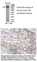 Anti-FBXO10 Antibody – Figure 1 of 1