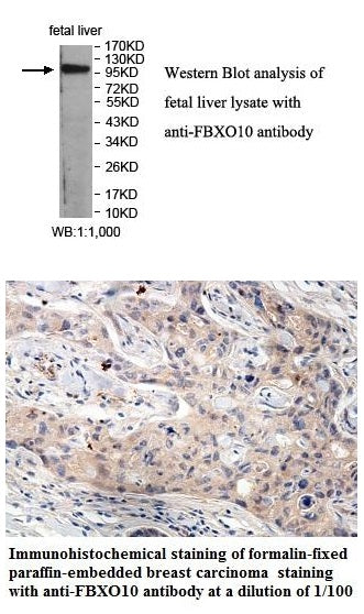 Anti-FBXO10 Antibody – Figure 1 of 1