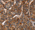 CACNB2 Polyclonal Antibody – Figure 1 of 3