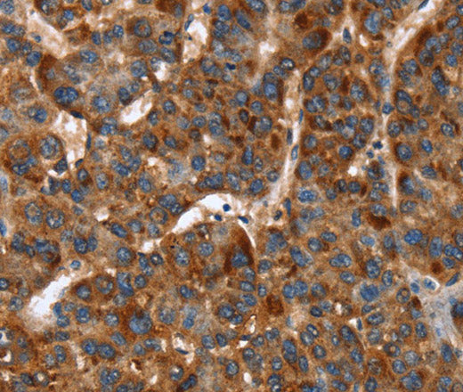 CACNB2 Polyclonal Antibody – Figure 1 of 3