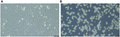 Phase-contrast micrographs of immortalized mouse brown preadipocytes: adherent fibroblast-like cells at confluence (left) and rounded, detached cells after trypsinization (right).