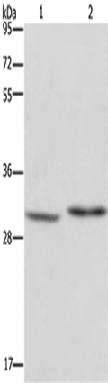 DHRS3 Polyclonal Antibody – Figure 1 of 4