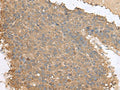 FAM19A4 Polyclonal Antibody – Figure 1 of 3